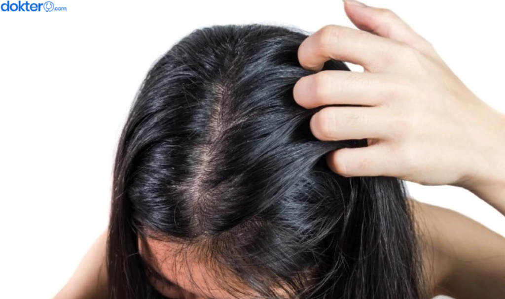 Cara Mengatasi Rambut Berminyak