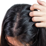 Cara Mengatasi Rambut Berminyak