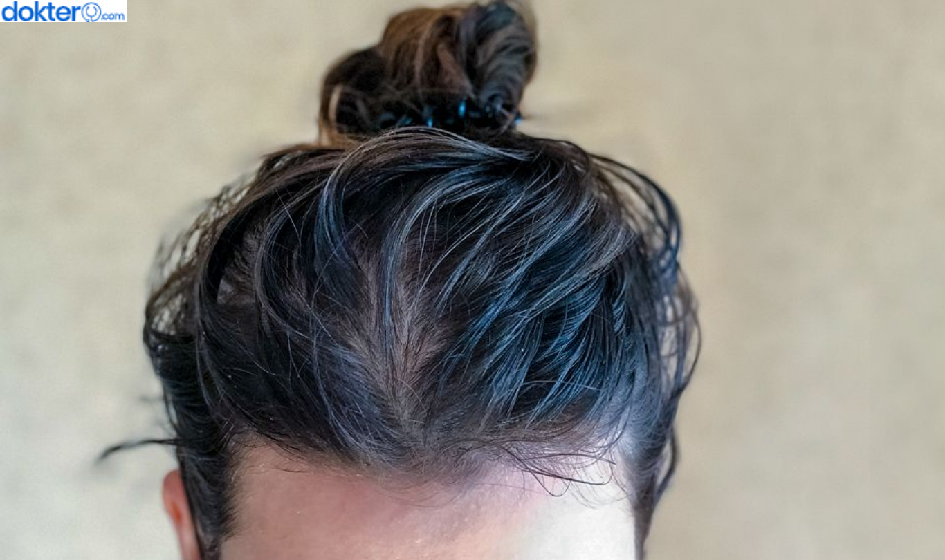 Cara Mengatasi Rambut Berminyak