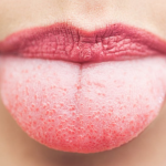 cara mengatasi lidah pahit saat hamil