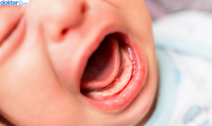 cara mengatasi sariawan pada bayi