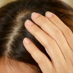 cara mengatasi kulit kepala kering