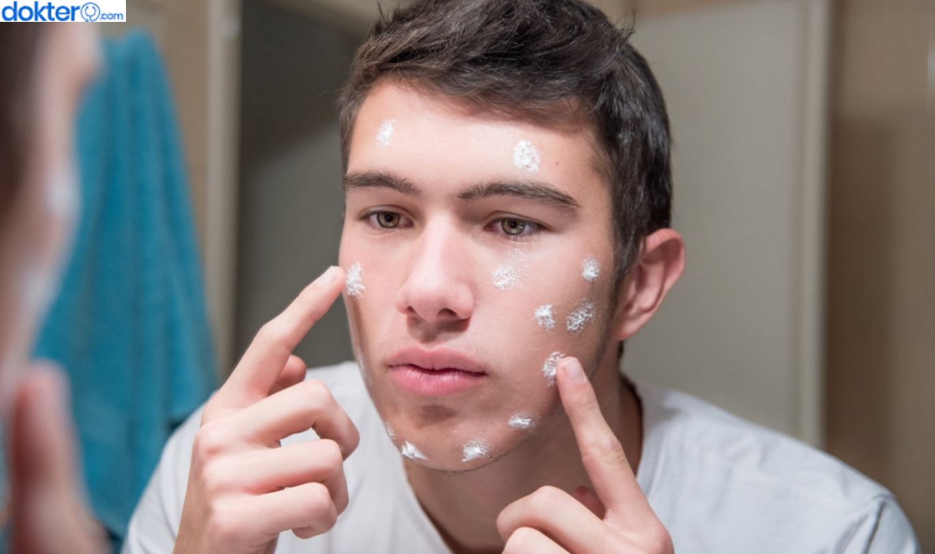 cara mengatasi jerawat hormonal pada pria